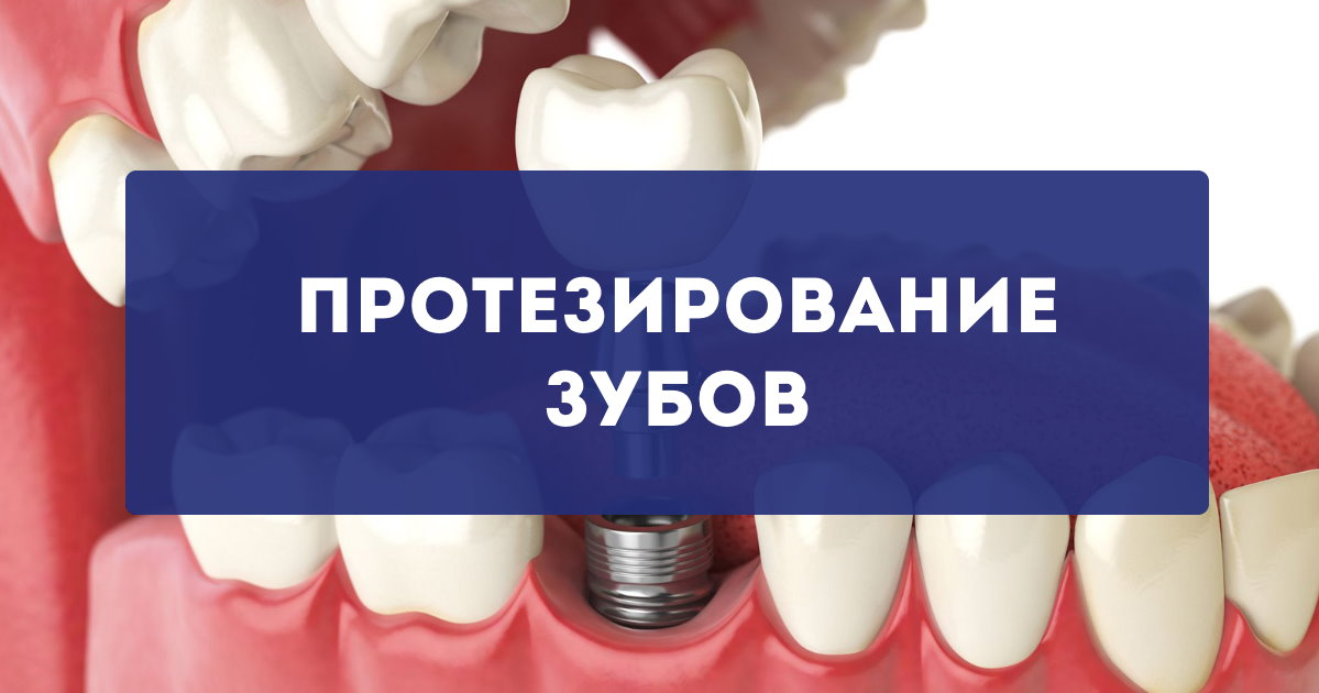 Где вставить зубы недорого качественно. Зубопротезирование в Тюмени. Протезирование в рассрочку преимущества. Стоматология ул Герцена протезирование. Зубопротезирование в рассрочку в Усть-Илимске.