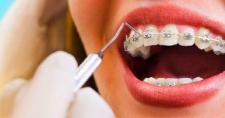 Стоматологическая ортодонтия Тюмень