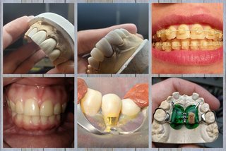 2020.02.13 Услуги стоматологии и лечение зубов и десен в Тюмени ДокторЗуб