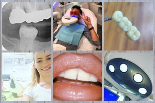 2020.03.16 Услуги стоматологии и лечение зубов и десен в Тюмени ДокторЗуб