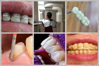 2020.07.05 Услуги стоматологии и лечение зубов и десен в Тюмени ДокторЗуб